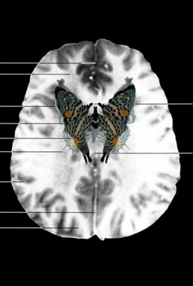 Suzanne Anker, MRI Butterfly (3), 2008.? Inkjet print on watercolor paper, 13 x 19 inches. Courtesy of the Artist