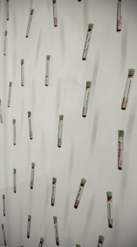 Jordan Eagles, Community Pint, 2016 (detail). 50 labeled blood collection tubes, preserved in plexiglass, UV resin, 84 x 28 x 2 inches. Courtesy of the Artist